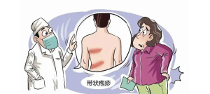 带状疱疹早知道：防治知识全知晓