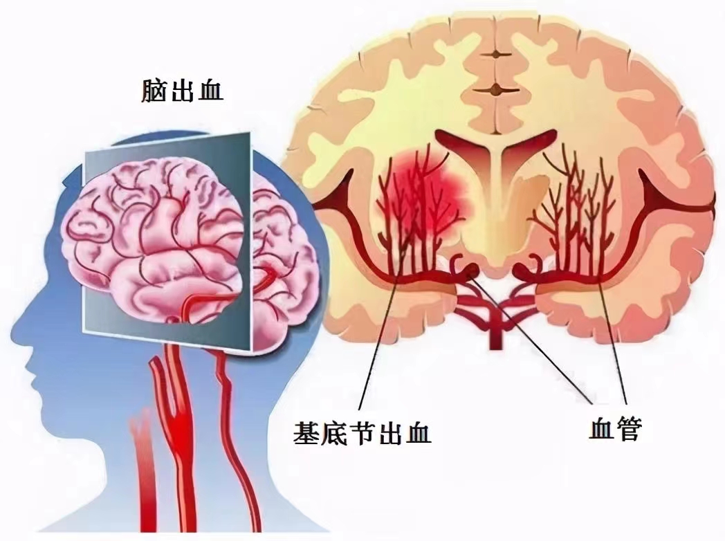 宁南县人民医院