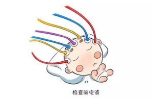 癫痫、脑病患者的福音 ——神经医学科开展脑电图检查啦!