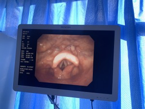 我院电子喉镜全面升级，精准诊疗再添新翼