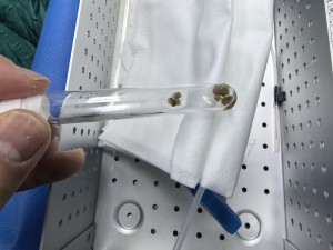 经皮肾镜取石术：微创治疗，结石无忧！