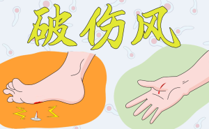 小伤口隐藏大危机——警惕破伤风